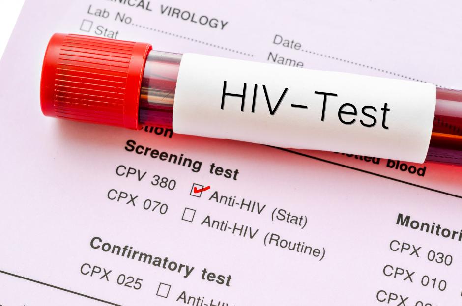 HIV-Test result and test bottle