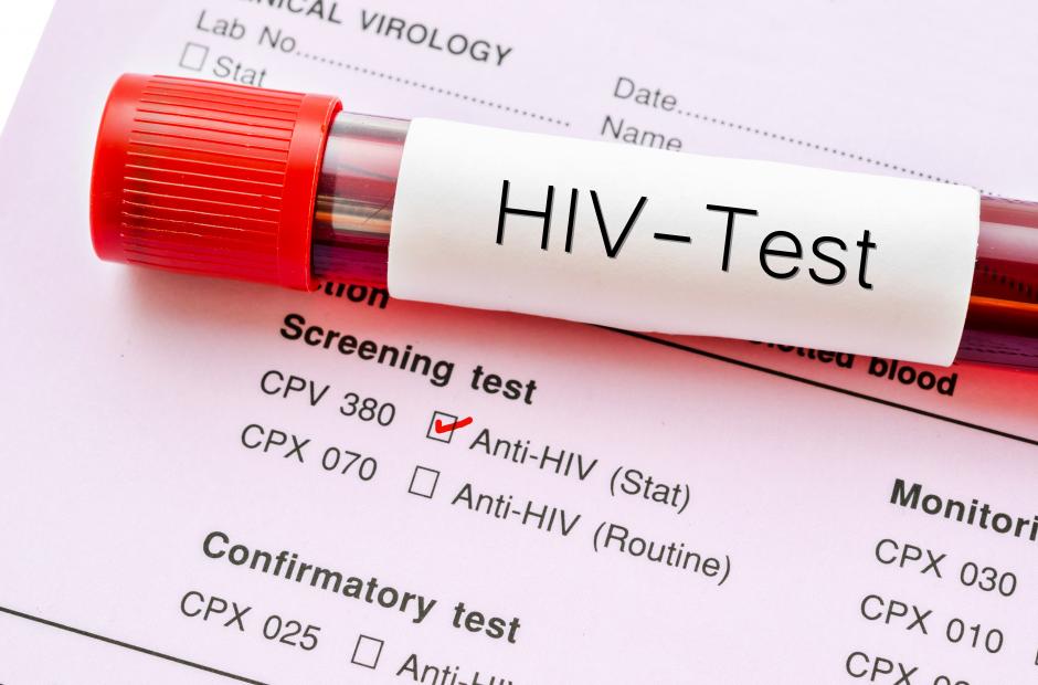 HIV-Test result and test bottle